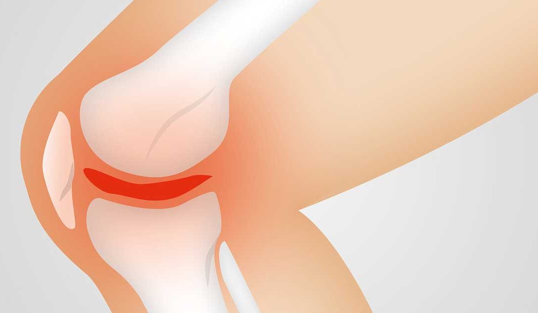 ACL injury treatment miami