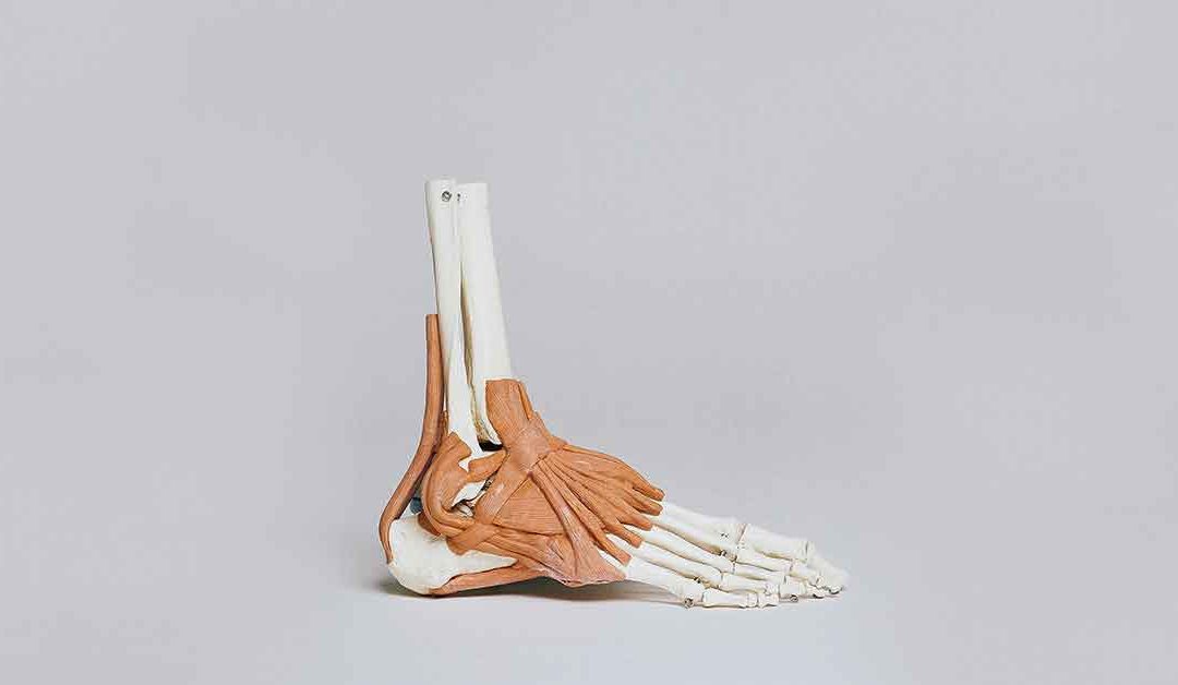 ankle arthritis treatment Miami