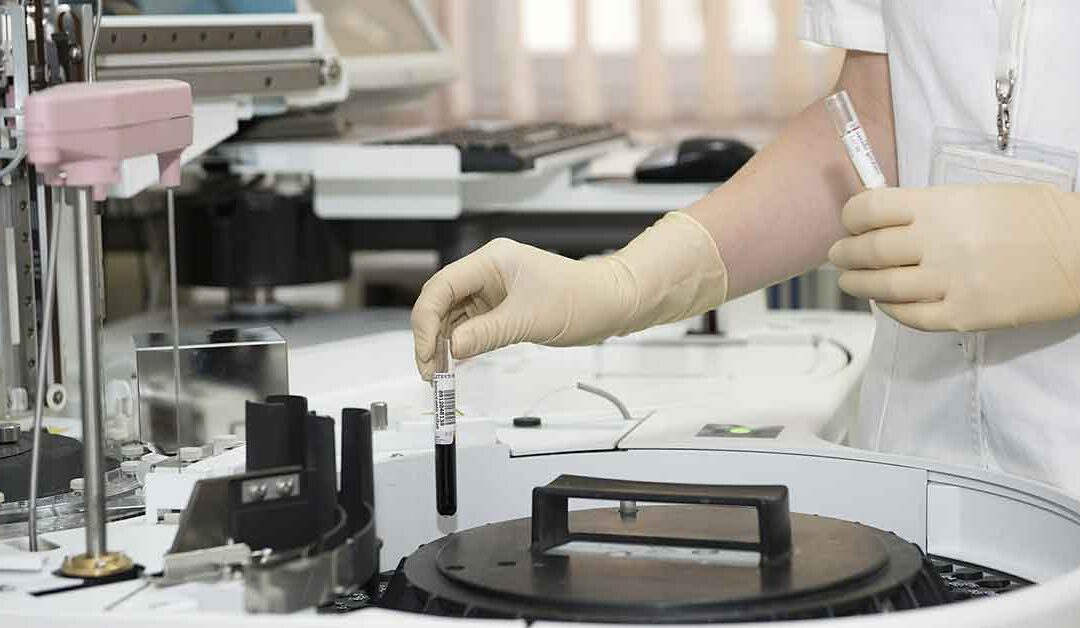 A possible cure for sickle cell using Stem Cell Therapy?