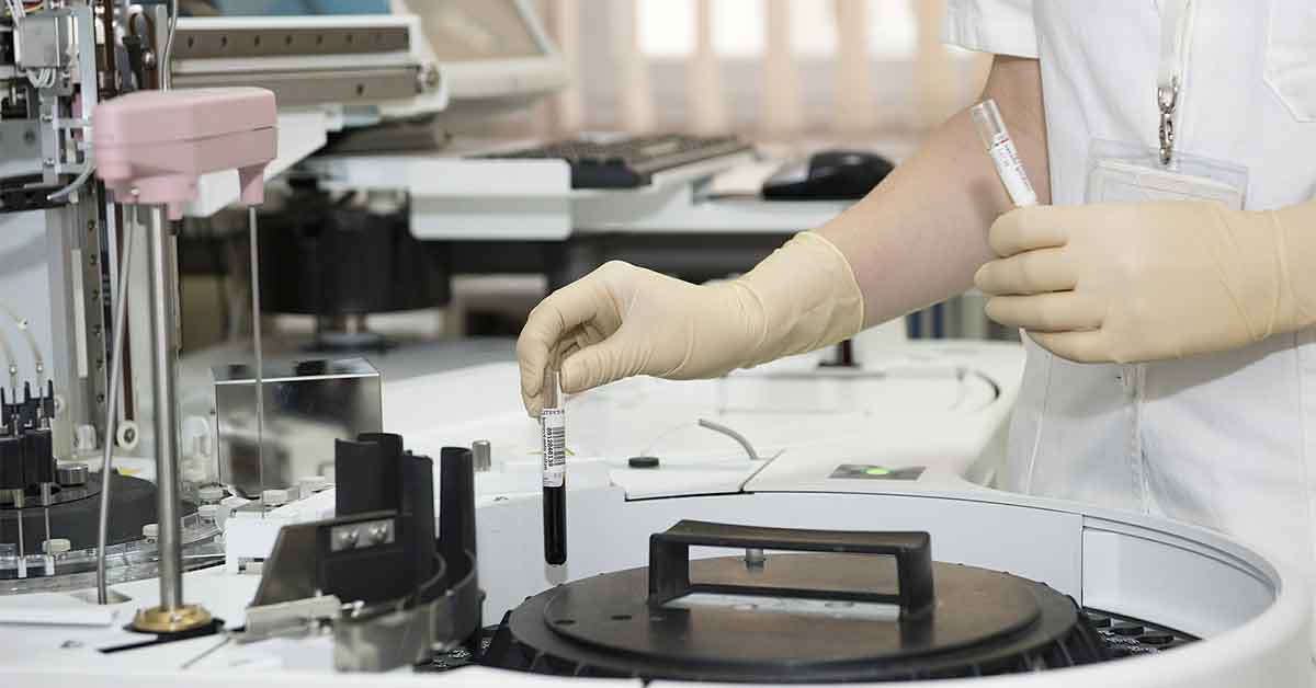 treatment for fibrosis Miami
