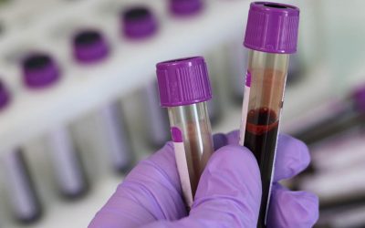 Different Types of Stem Cells and What They Do