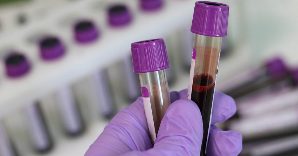 types of stem cells in miami 1024x536