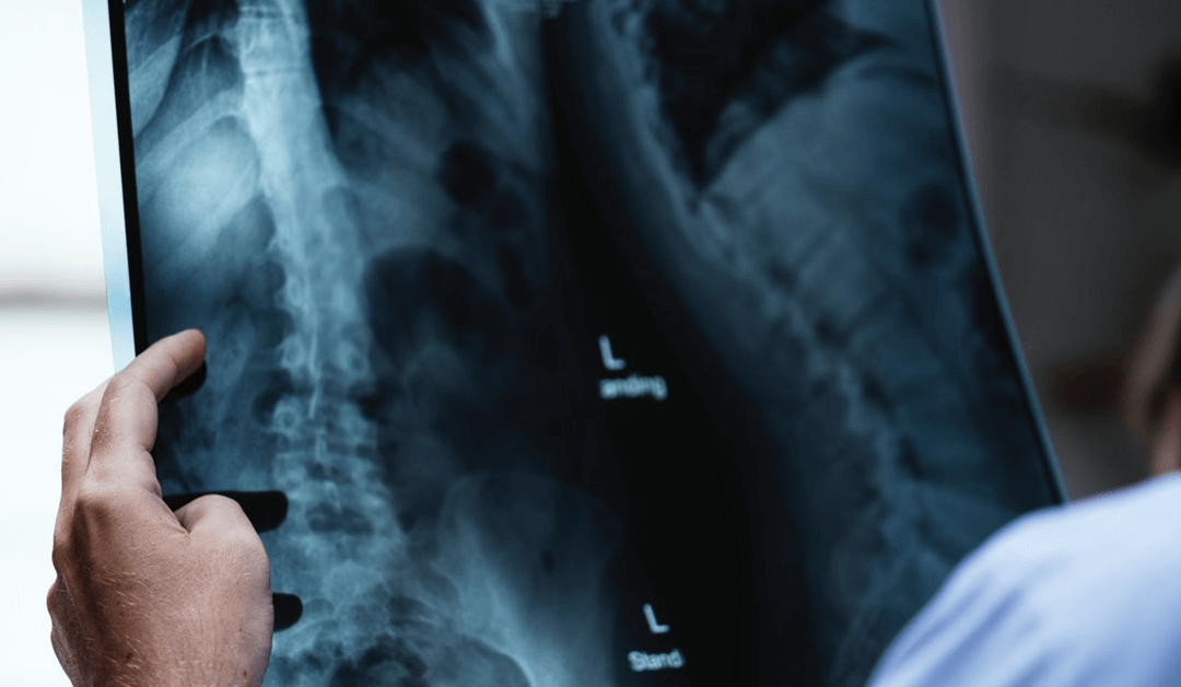 Could Stem Cells Cure ALS One Day?