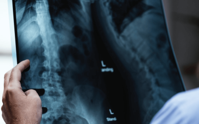 Could Stem Cells Cure ALS One Day?