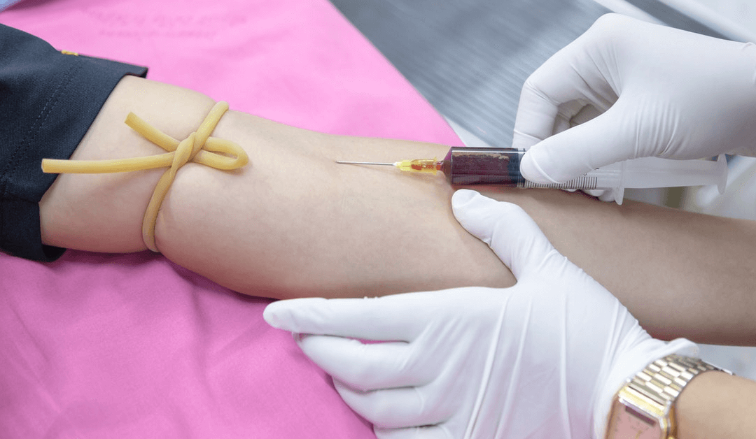 What is Intracellular Micronutrient Testing?