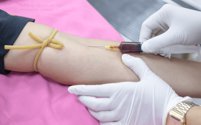 What is Intracellular Micronutrient Testing?