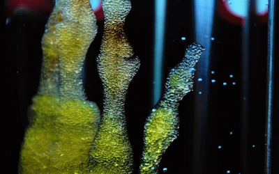 The different types of regenerative medicine.