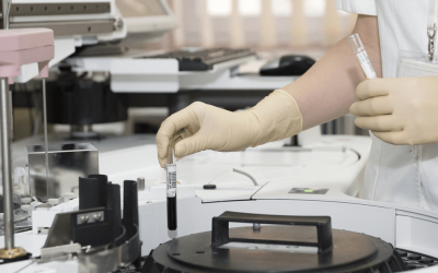Stem Cell Therapy for UI in Females – A Must Try!