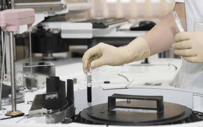 Coronavirus: What is Convalescent Plasma Therapy?