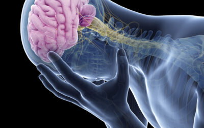 Suffered a recent stroke?