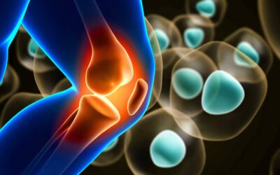 Study confirms safety of stem cell therapy for chronic knee pain: