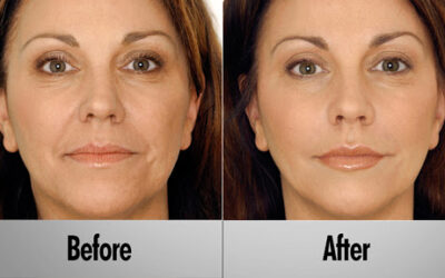 Stem Cell Beauty…the future is here!
