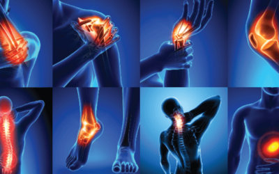 How Do Stem Cells Target Inflammation?