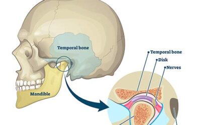 Mesenchymal Stem Cells for Cartilage Regeneration of TMJ Osteoarthritis
