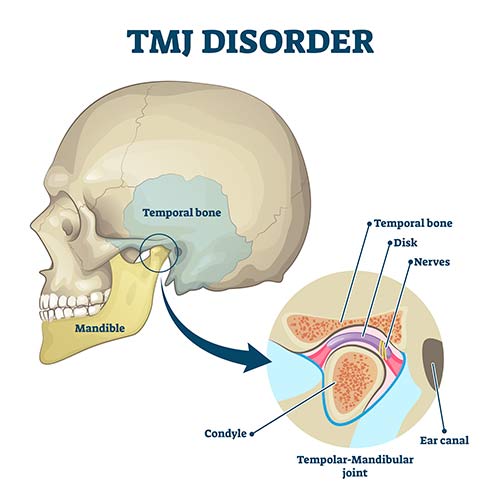Mesenchymal Stem Cells for Cartilage Regeneration of TMJ Osteoarthritis