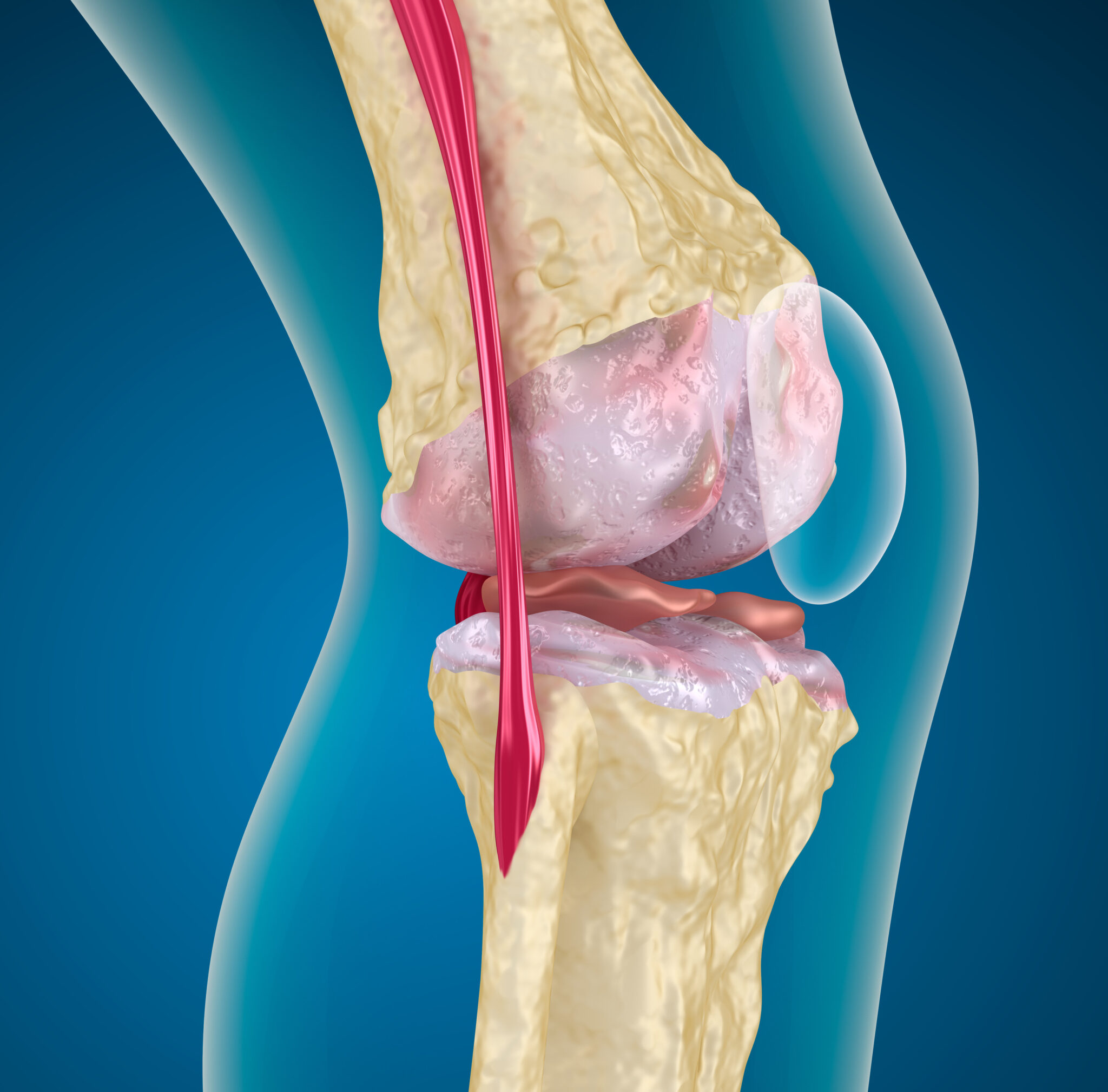 Knee pain 2021 9