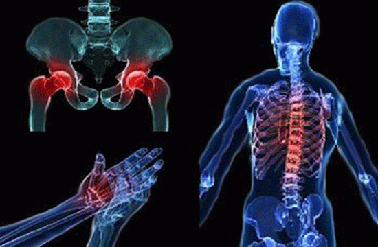 What is osteoarthritis (OA)?