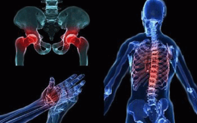 Mesenchymal stem cells in osteoarthritis therapy: a review
