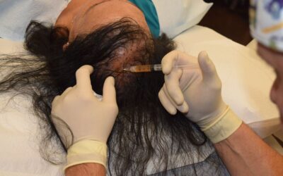 Is COVID-19 the Reason You’re Losing Hair?