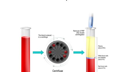 Variables affecting the potential efficacy of PRP in providing chronic pain relief