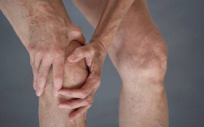 Stopping arthritis before it starts