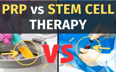Stem Cell Therapy Vs. PRP Therapy: Which is Right for You?