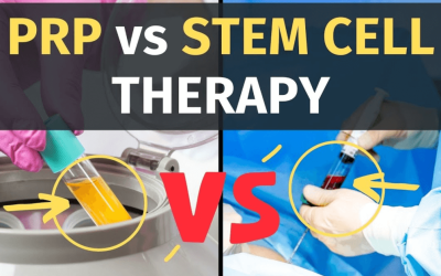 PRP Therapy vs. Stem Cell Therapy: What’s the Difference?