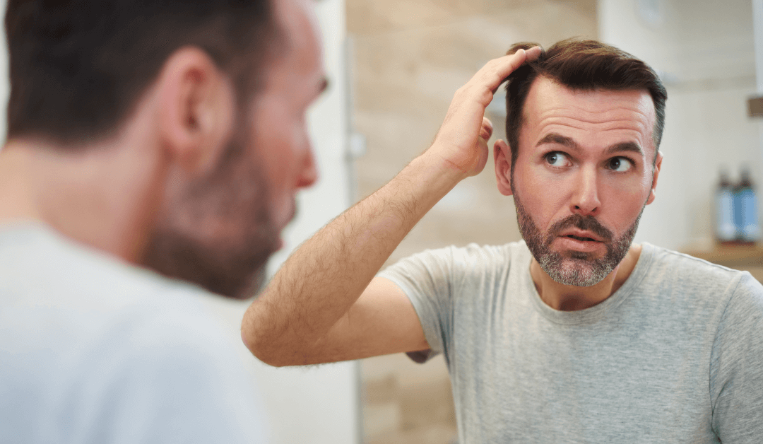 mature-men-is-worried-about-hair-loss