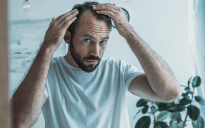 PRP Treatment for Hair Loss