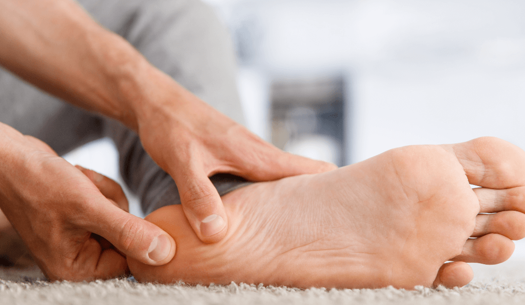 Calcaneal Spur